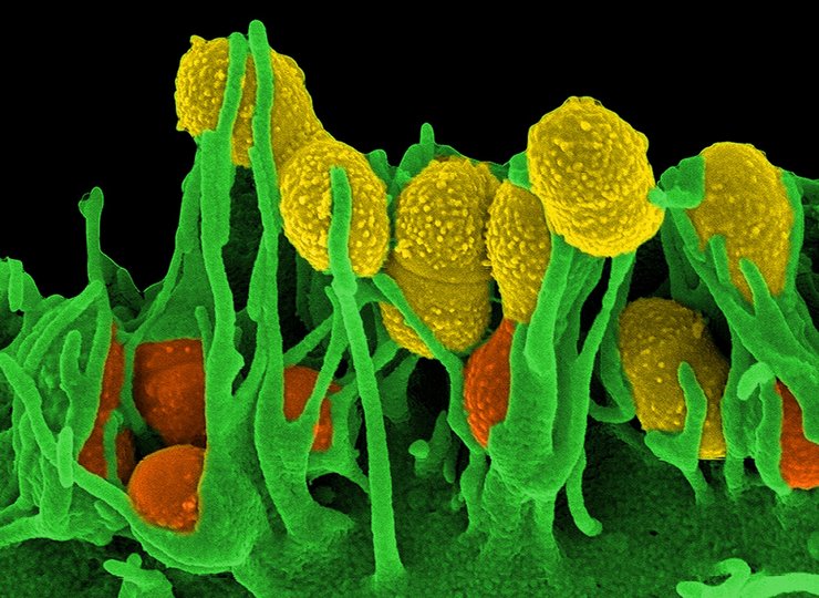 Mikroskopbild von Streptokokken.