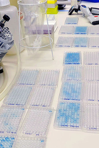 Unzählige Testgefäße mit möglichen Corona-Antikörpern auf einem Labortisch der TU Braunschweig.